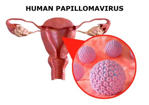 کارگاه آموزشی HPV (Human papillomavirus)